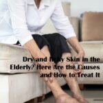 Dry and Itchy Skin