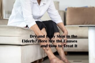 Dry and Itchy Skin